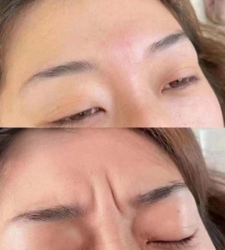 Diaminy Mono Threads forehead