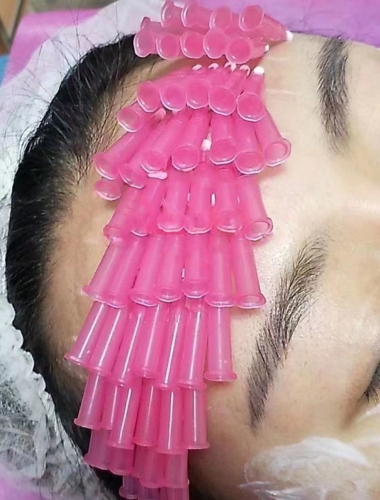 Diaminy smooth threads for forehead