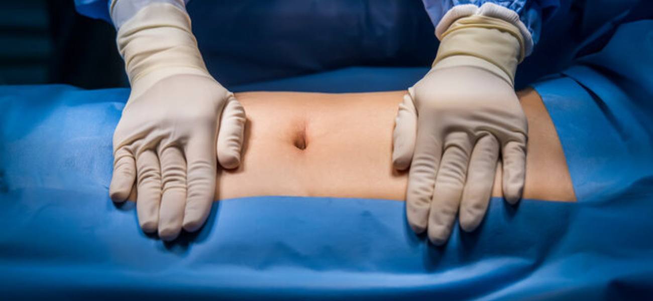 Abdominal Surgery