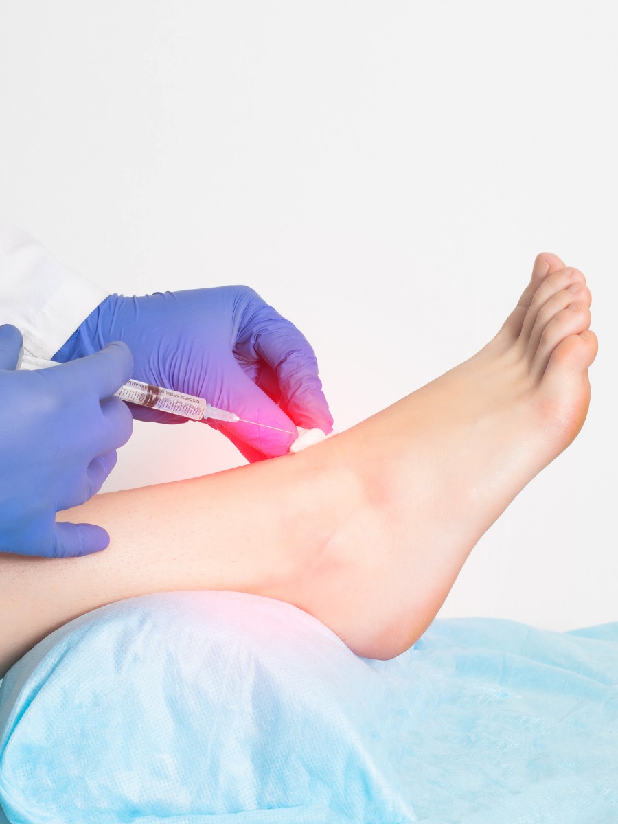 Non Cross Linked Hyaluronic Acid