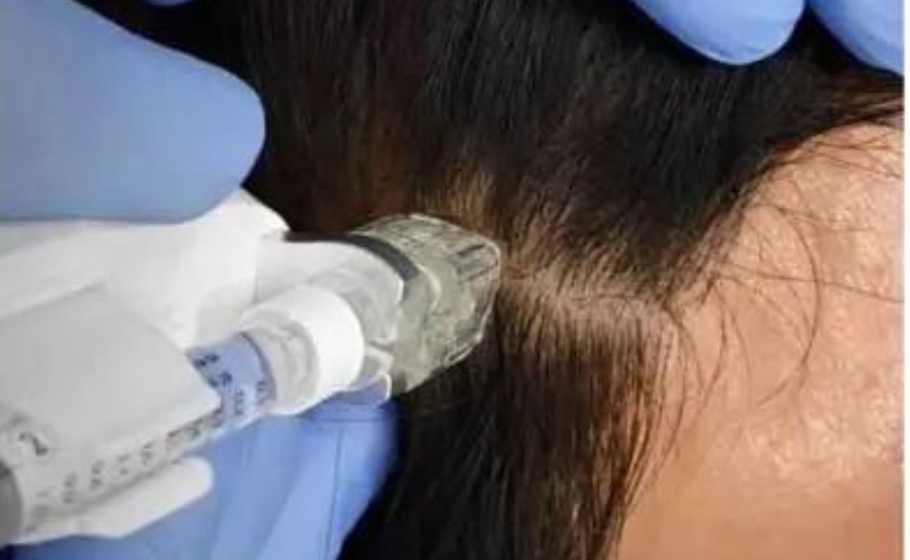 Crystal 9pin needle for hyaluronic acid injection
