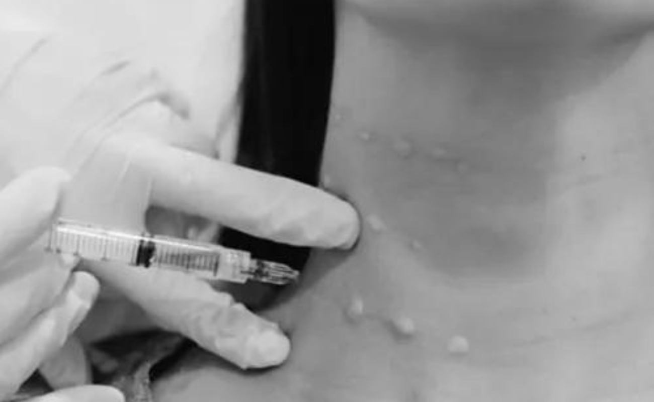 Crystal multi-needle injects botox into the neck