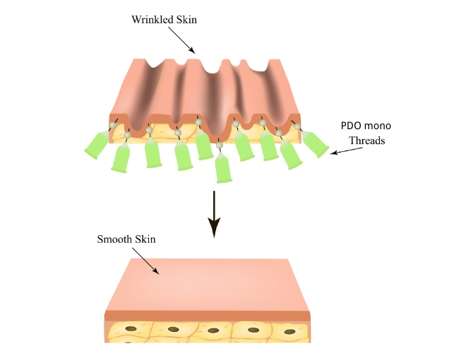 benefits of PDO mono threads