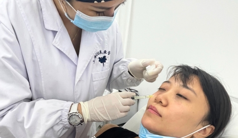 tear trough filler with cannula
