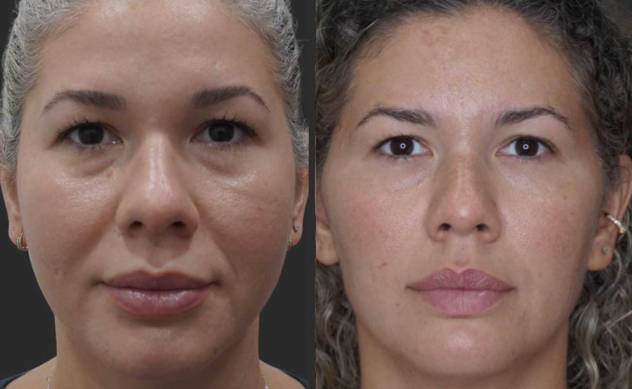 pcl cog threads for face