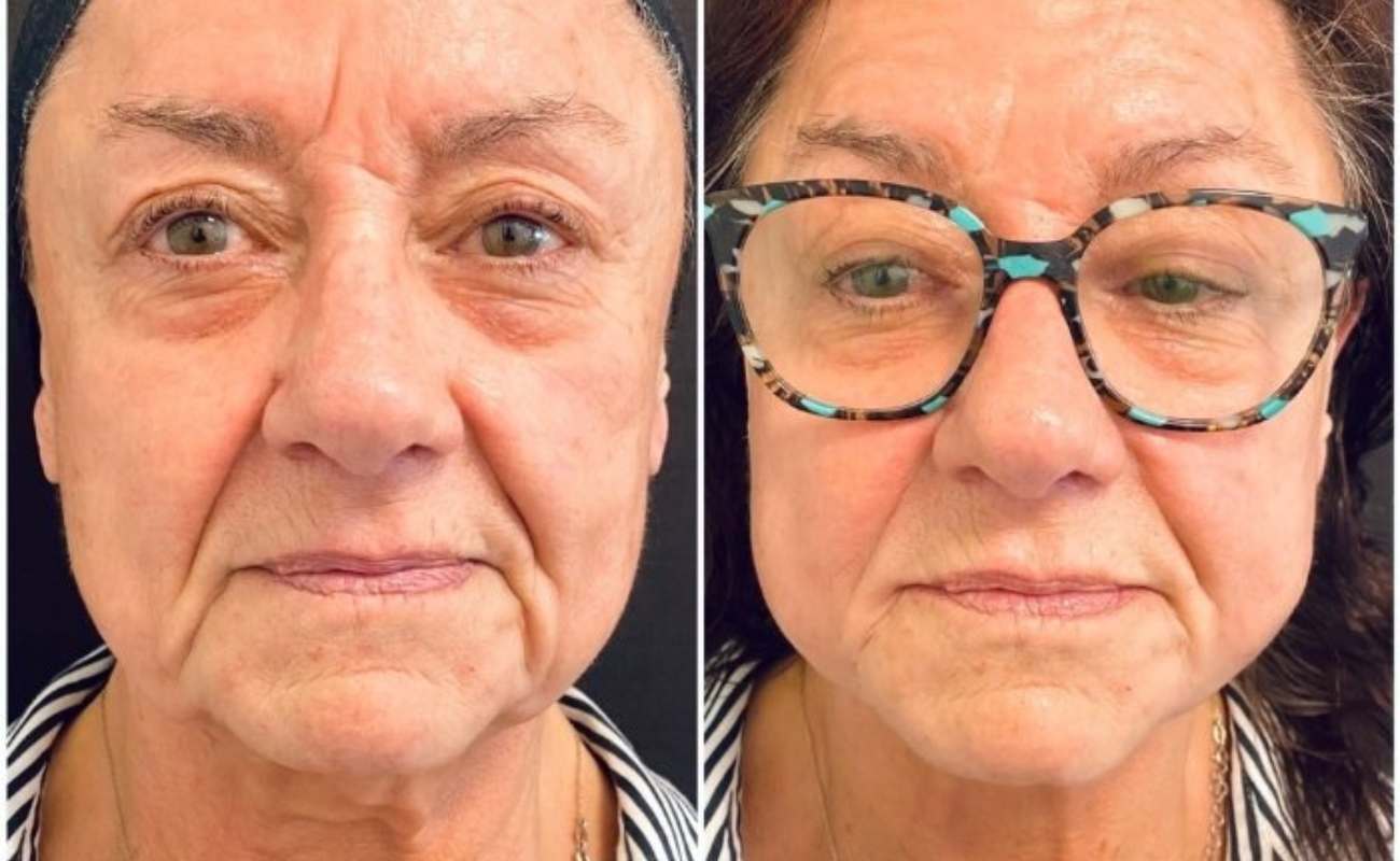 pcl cog threads for face