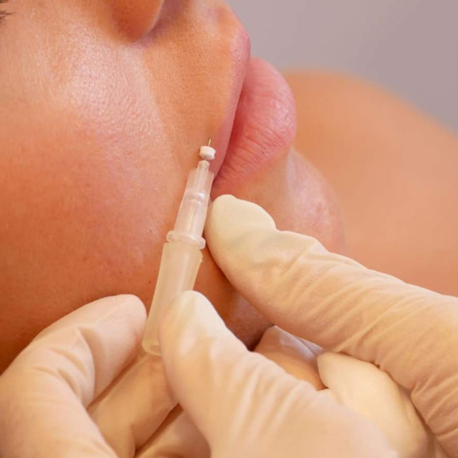 Effective Techniques for Dissolving PDO Threads Safely